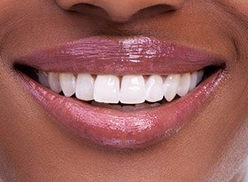 white teeth with pretty smile close up