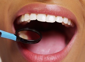 Closeup of healthy smile during dental exam