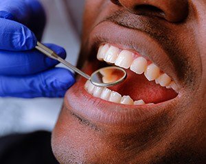 Closeup of patient receiving dental exam